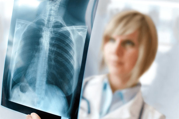 doctor looking at x-ray of spine