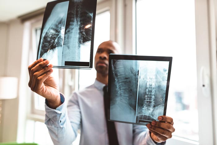 doctor examining x-rays of the spine