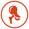radiculopathy